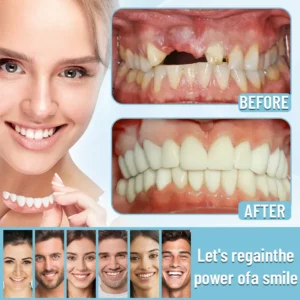 Bikenda® Official Store Advanced Full Denture Set