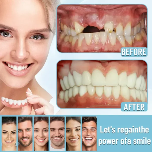 Bikenda® Official Store Advanced Full Denture Set