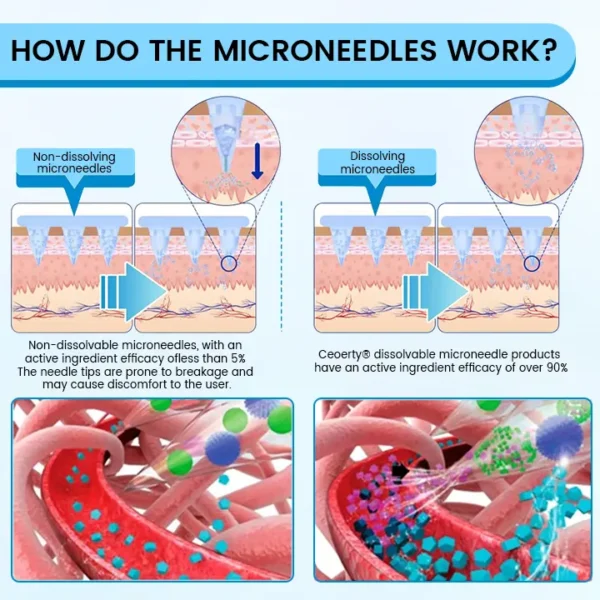 Ceoerty® GlucaLite GLP-1 Nano Microneedle Patch