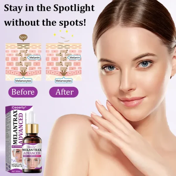 Ceoerty® MelantraX Advanced Anti-Hyperpigmentation Essence