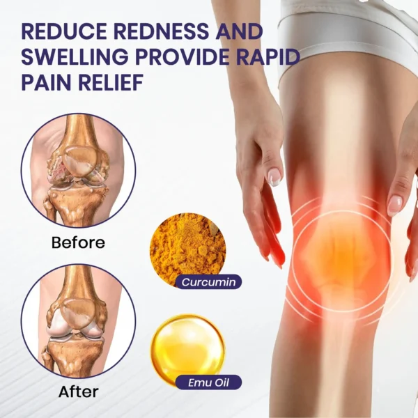 Lyyeto® Turmeric & Emu Oil Arthritis Soothing Pain Relief Massage
