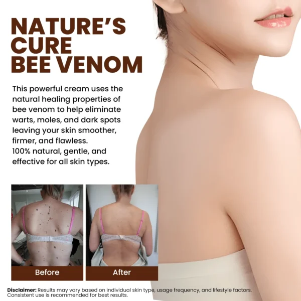 Lyyeto® Bee Venom Skin Treatment Cream