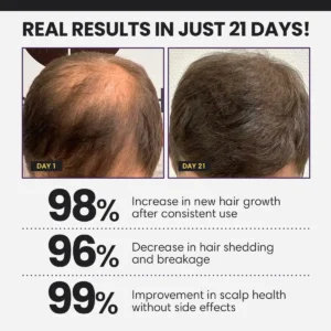Lyyeto® FollicleBoost 5X Hair Growth Serum