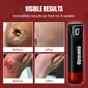 Lyyeto® Glyconova Blood Sugar Inhaler