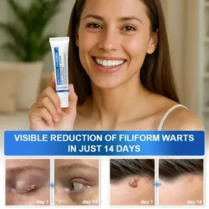 LYYETO® HPV Facial Filiform Warts Removal Cream
