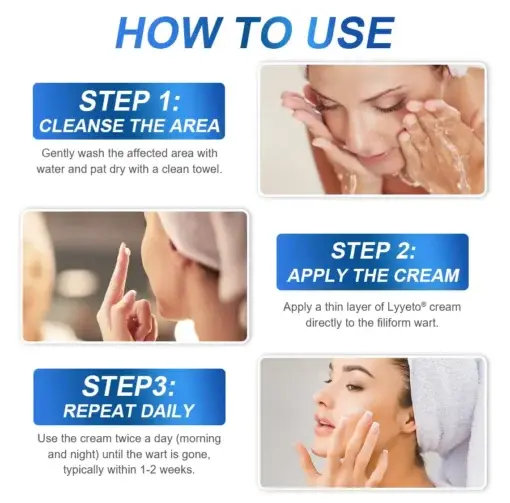 LYYETO® HPV Facial Filiform Warts Removal Cream