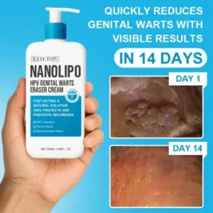 LYYETO® NANOLIPO HPV GENITAL WARTS ERASER CREAM