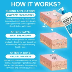 LYYETO® NANOLIPO HPV GENITAL WARTS ERASER CREAM