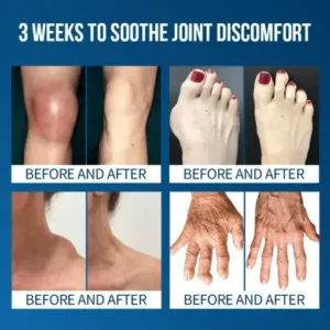 Lyyeto® Flexfixer Joint Relief Serum Ampoule