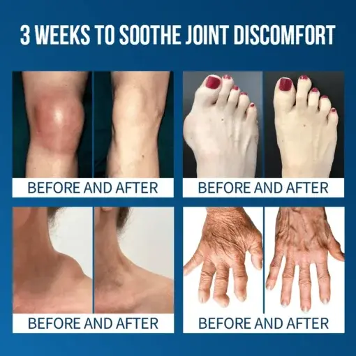 Lyyeto® Flexfixer Joint Relief Serum Ampoule