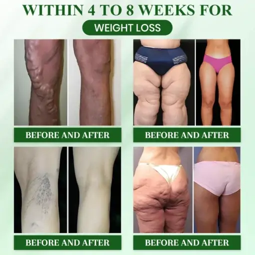 Lyyeto® GLP-1 Slimming Oral Drops