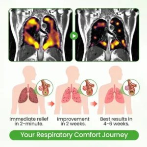 Lyyeto® HerbaAir Mullein Lung Purifier ACE 1