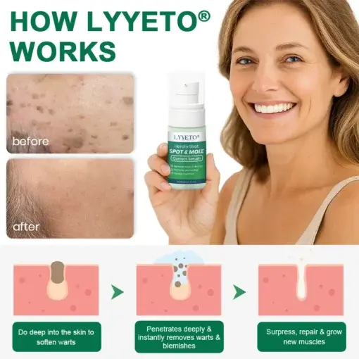 Lyyeto® Herdle Shot Spot & Mole Correct Serum