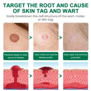 Lyyeto® Herdle Shot Spot & Mole Correct Serum