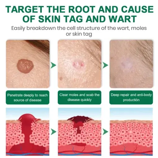 Lyyeto® Herdle Shot Spot & Mole Correct Serum