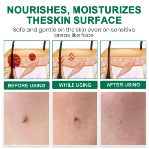 Lyyeto® Herdle Shot Spot & Mole Correct Serum