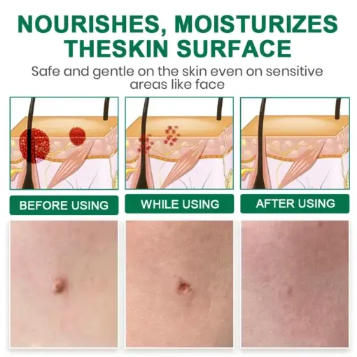 Lyyeto® Herdle Shot Spot & Mole Correct Serum