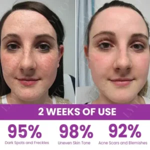 Lyyeto® MelantraX Advanced Brightening Essence ACE