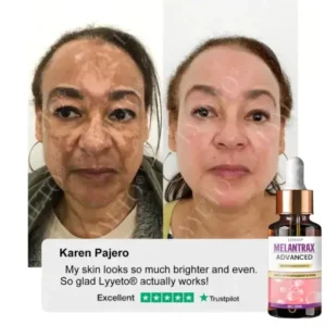 Lyyeto® MelantraX Advanced Brightening Essence ACE