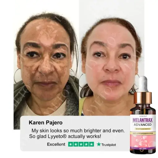 Lyyeto® MelantraX Advanced Brightening Essence ACE