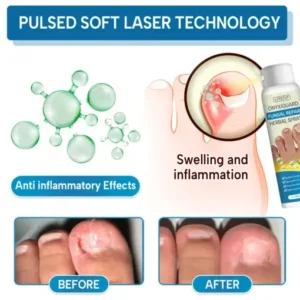 Lyyeto® OnyxiGuard Fungal Repair Herbal Spray