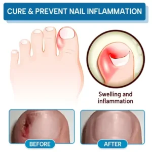 Lyyeto® OnyxiGuard Fungal Repair Herbal Spray