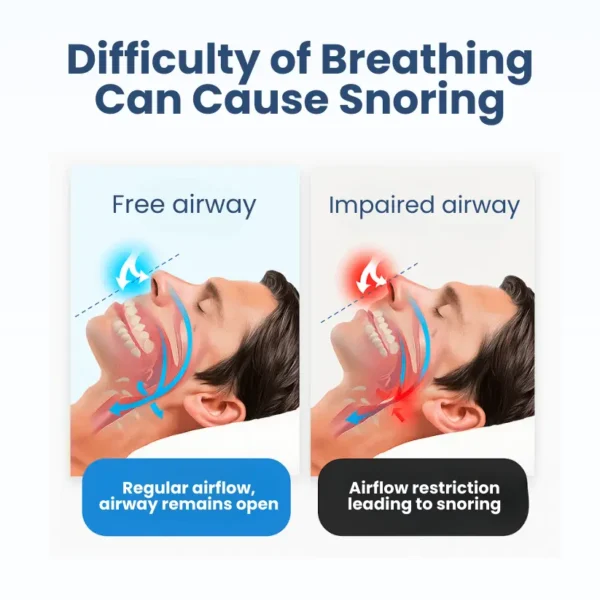 Lyyeto® Snoreless Nasal Breather ACE