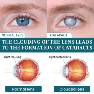 Lyyeto® OptiFusion Nano Eye Drops Serum