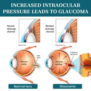 Lyyeto® OptiFusion Nano Eye Drops Serum