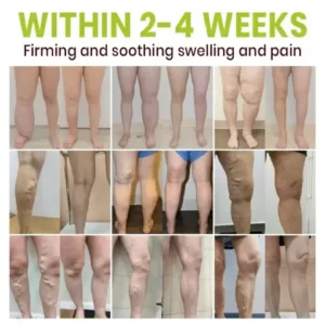 Lyyeto® Professional Leg Circulation Cream