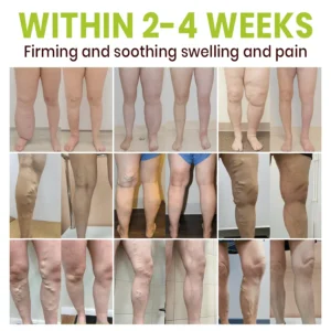 Lyyeto® Professional Leg Circulation Cream_Ultra02