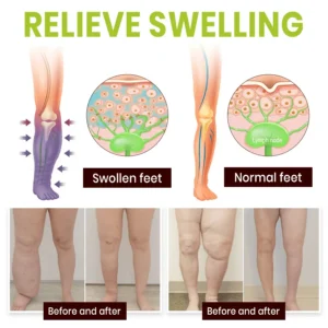 Lyyeto® Professional Leg Circulation Cream_Ultra02