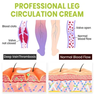 Lyyeto® Professional Leg Circulation Cream_Ultra02